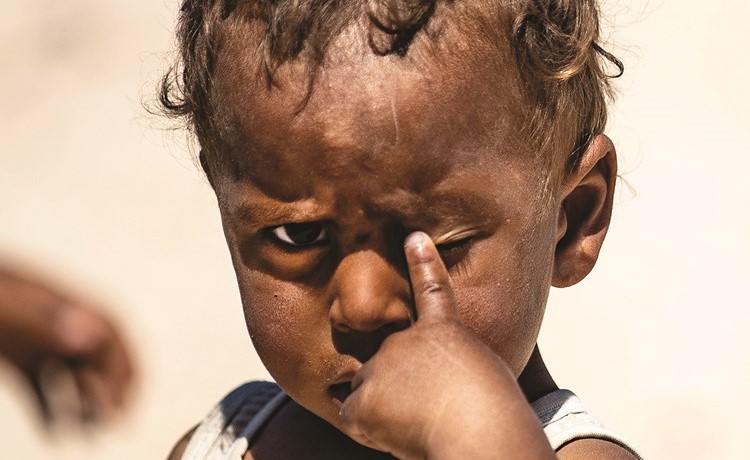 طفل سوري لاجئ يفرك عينه في مخيم واشوكاني في الحسكة	(أ.ف.پ)