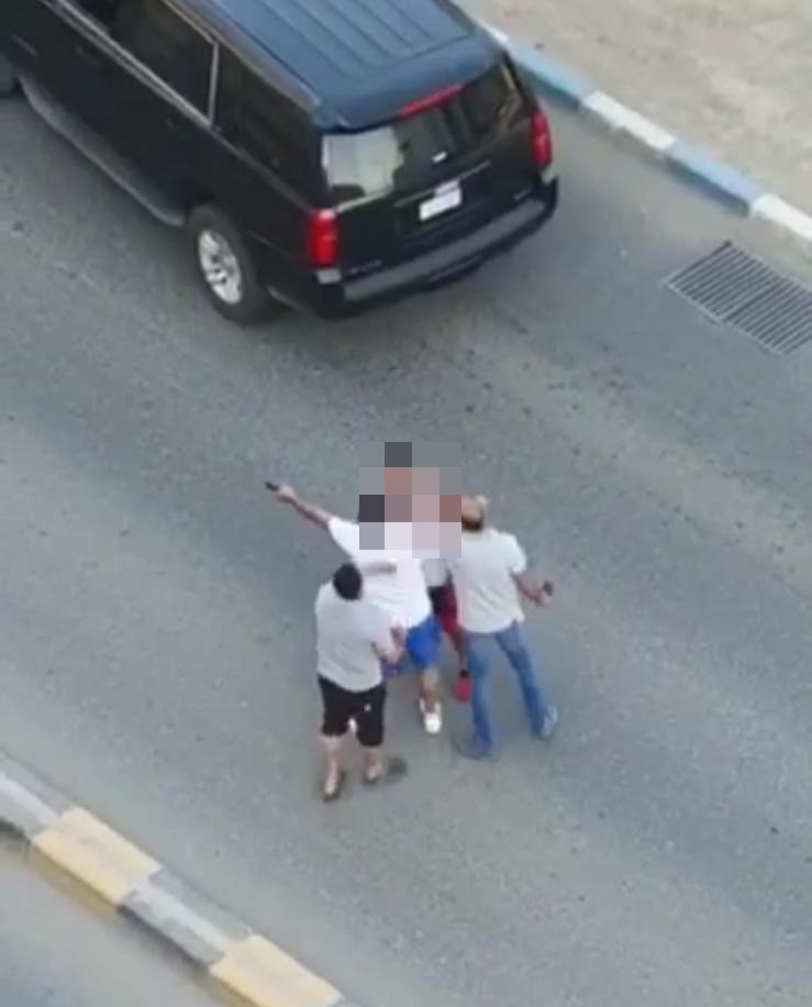 مواطن يبلغ عن تعرضه للضرب في السالمية أثناء المشي .. وتكليف المباحث بضبط الجاني
