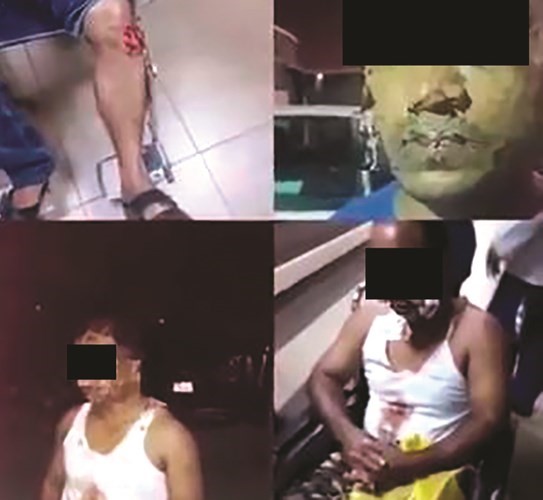 صور لوافدين تعرضو للتعذيب من قبل المتهم وشريكه
