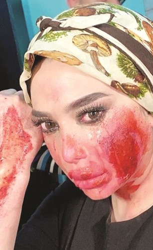 رنا الأبيض مشوهة في مسلسل بروكار