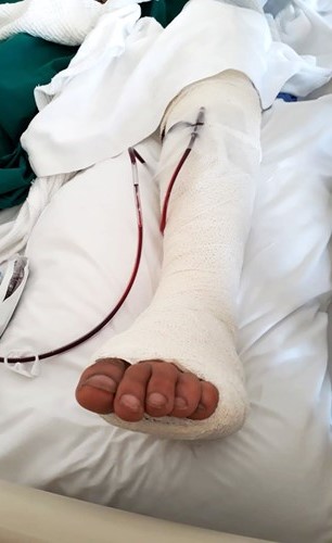 المجني عليه وقد تعرض لجروح واشتباه في تمزق بالعصب