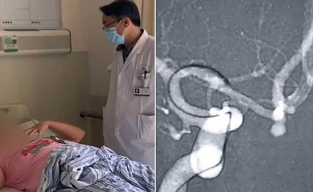 بالفيديو.. حاولت الغناء بأعلى صوتها فانفجر وعاء دموي في دماغها