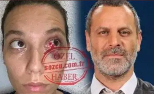 حبسها وضربها بعنف ثم نقلها إلى المستشفى.. نجم "حريم السلطان" متهم بالاعتداء على حبيبته