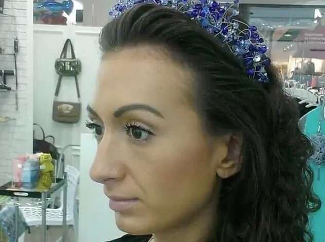 بالفيديو والصور.. نتائج مفجعة لفتاة اوكرانية حقنت وجهها بنفسها للظهور أكثر جمالاً!
