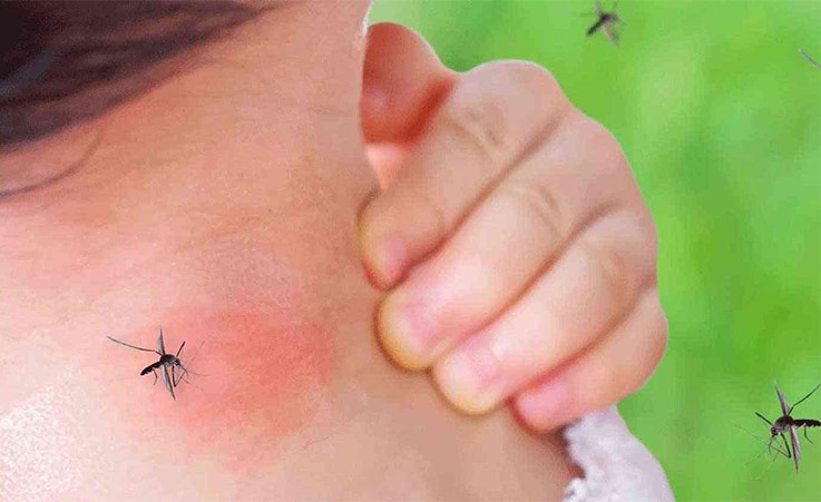 لدغة البعوضة تصبح خطيرة إذا لدغتك في هذا المكان