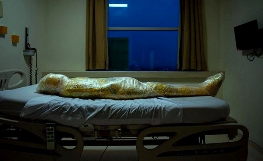 صورة مرعبة لأحد ضحايا كورونا يبدو فيها كأنه من كوكب آخر