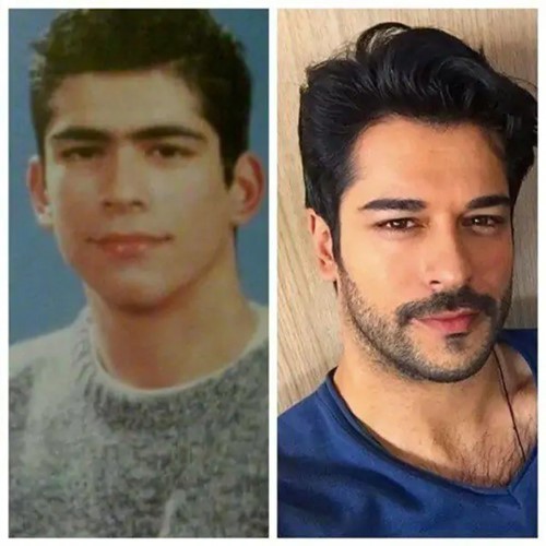 صورة لبوراك أوزجفيت ما قبل الشهرة.. ملامحه مختلفة كليا