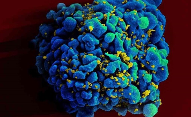 معجزة علمية.. أول حالة شفاء من الإيدز دون أدوية أو جراحة