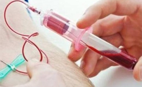 فحص للدم يحدد المرضى المعرضين لتفاقم أعراض كورونا