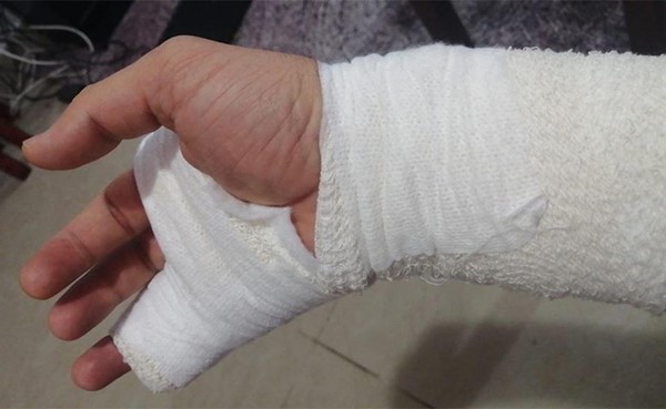 الاعتداء على طبيب بمستشفى الرازي لمنعه شخصاً من زيارة قريبته المصابة بكورونا