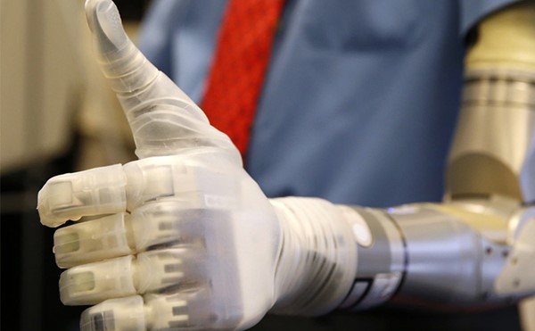 تطوير ذراع روبوتية تستعيد الوظائف الطبيعية لمبتوري الأطراف العلوية