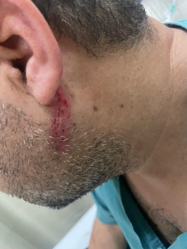 طبيب في مستشفى الولادة يتعرض لاعتداء بالضرب.. والجمعية الطبية تمضي في الإجراءات القانونية بحق المعتدي