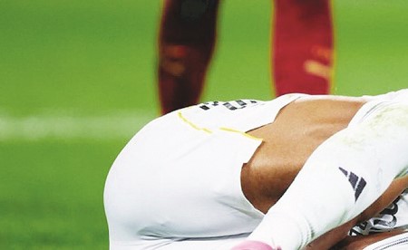 مبابي يتعرض للإصابة في أوتار الركبة